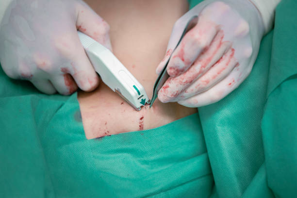 /uploads/image/2025/09/29/surgical-skin-stapler-3.jpg surgical-skin-stapler-3.jpg