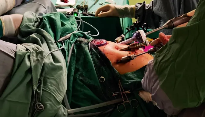 CAK Medical Device in the Operating Room