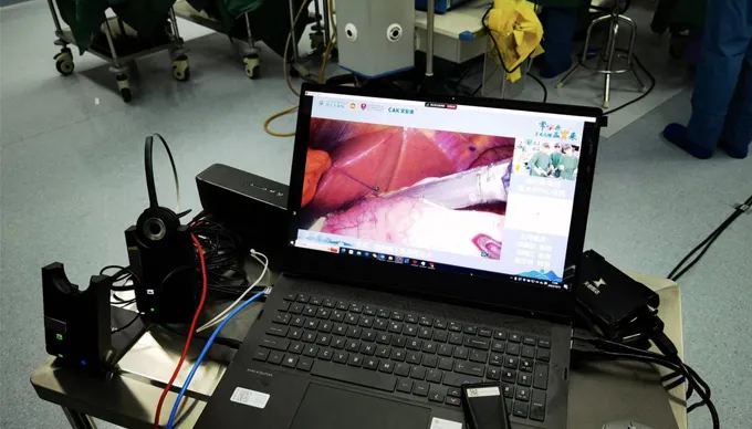 CAK Surgical Staplers Shine in Six Live Surgeries Across China